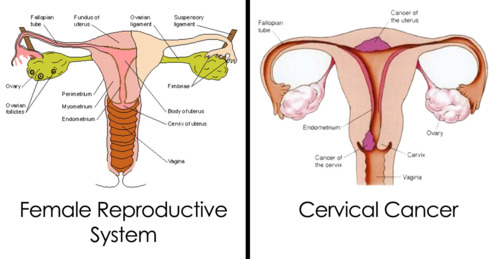 pain in cervix area during intercourse